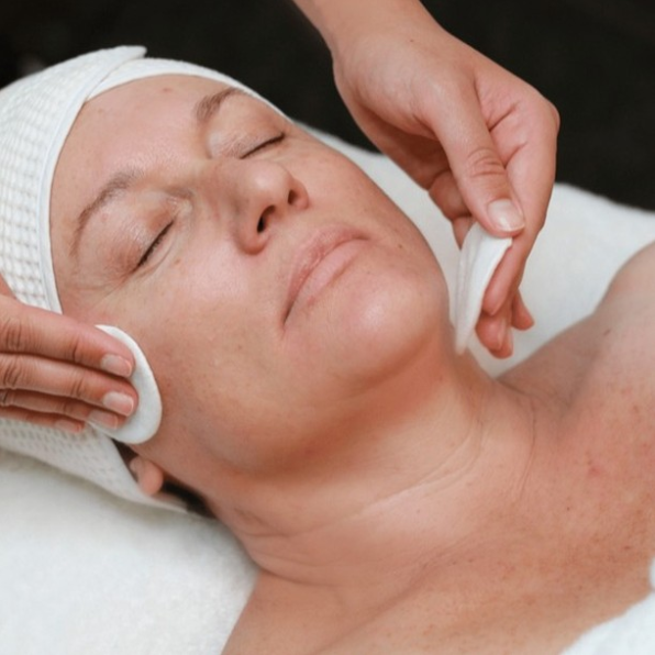 Chemical Peel Ultraceuticals Facial